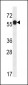 ARMT1 Antibody (N-term)